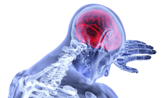 What Caused Sean's Brain Injury