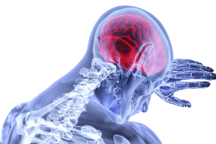 What Caused Sean's Brain Injury